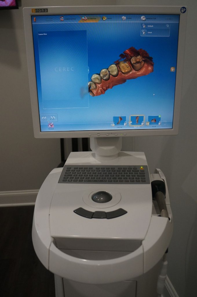 CEREC same day crown scanner